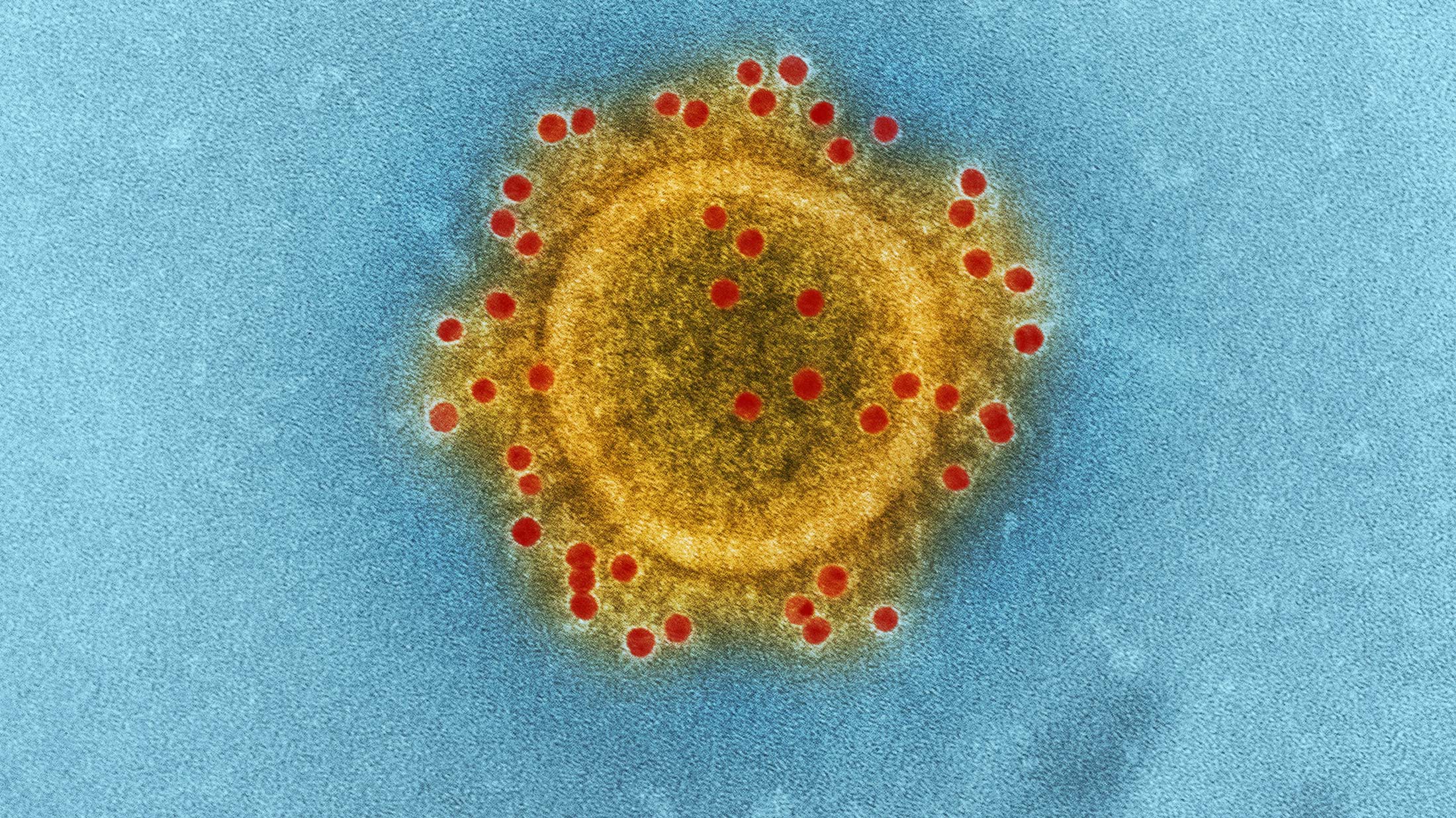 AI Has Designed Complete Viral Genomes From Scratch. The Implications Cut Both Ways.