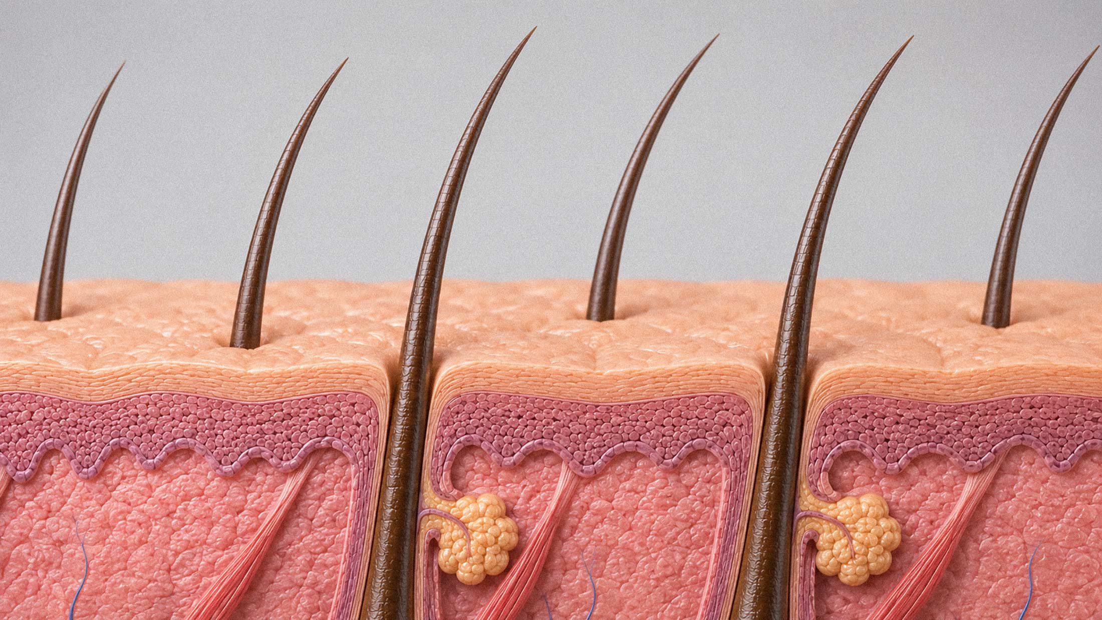 AI-Designed Nanozymes Are Outperforming Minoxidil in Hair Loss Research.