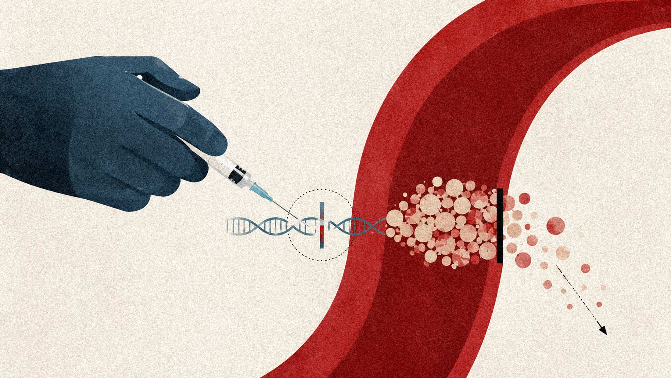 Eli Lilly's One-Shot Cholesterol Therapy Hits 88% PCSK9 Reduction in Phase 1, Gets Published in NEJM
