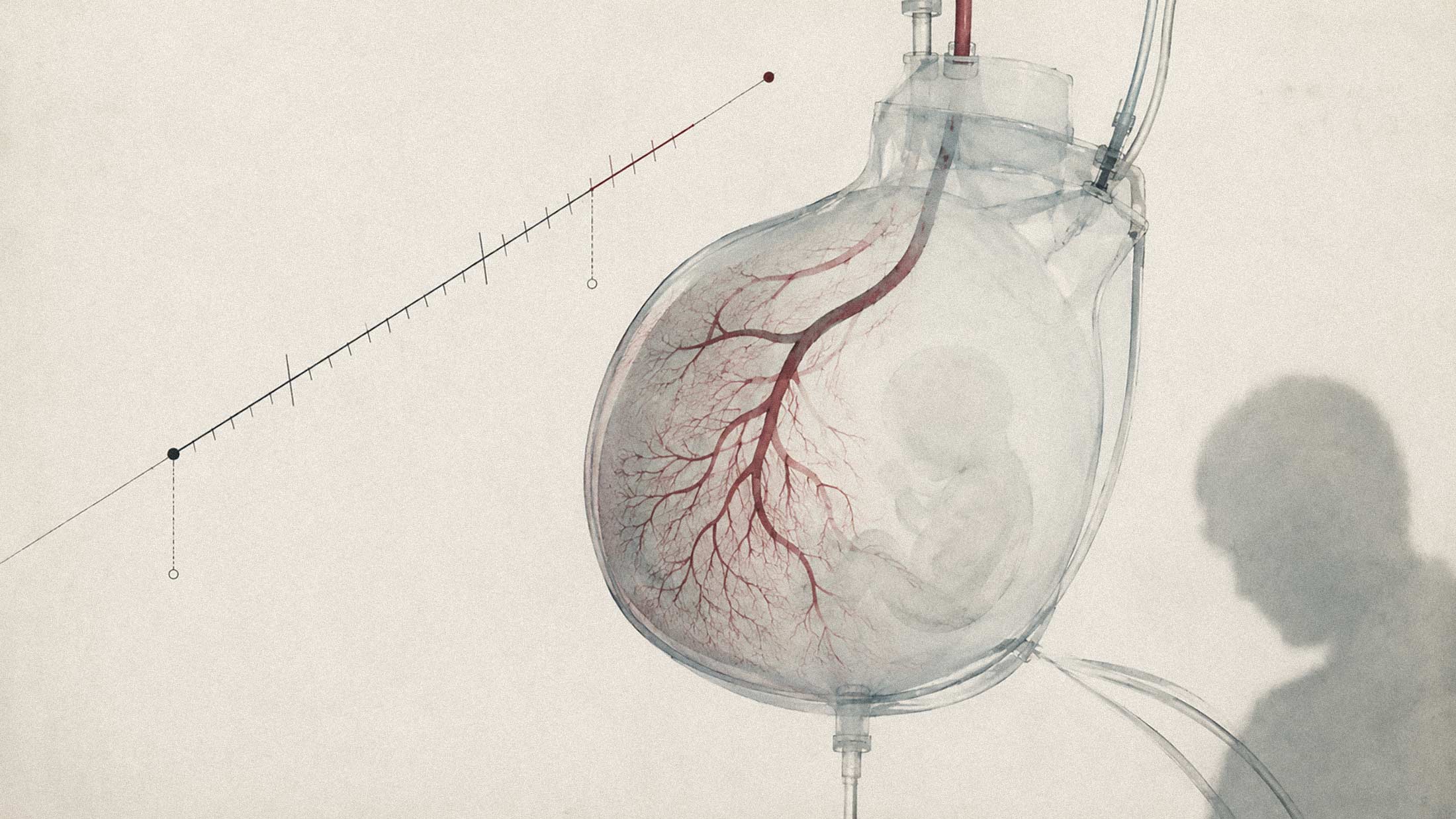 Kangaroo Biomedical Wants to Build an Artificial Womb for Humans. Its Five-Year Timeline Has Raised Eyebrows.