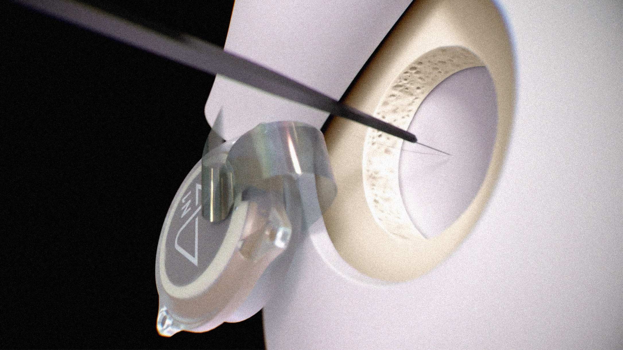 Neuralink Completes First Transdural Implant, Eliminating One of Brain Surgery's Most Delicate Steps